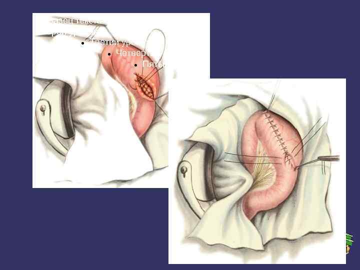 Образец текста Второй уровень Третий уровень Четвертый уровень Пятый уровень 