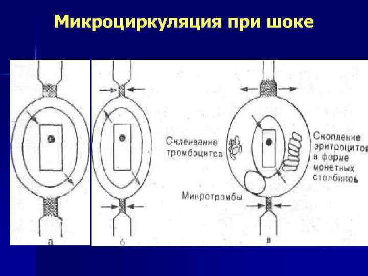 Микроциркуляция при шоке 