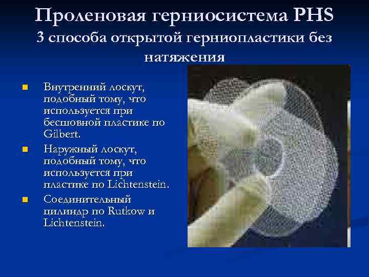 Проленовая герниосистема PHS 3 способа открытой герниопластики без натяжения n n n Внутренний лоскут,