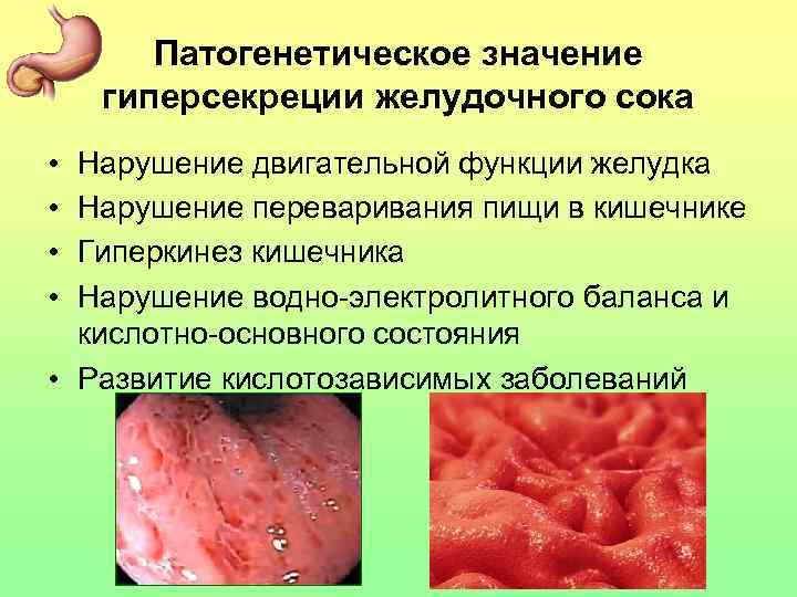 Патогенетическое значение гиперсекреции желудочного сока • • Нарушение двигательной функции желудка Нарушение переваривания пищи