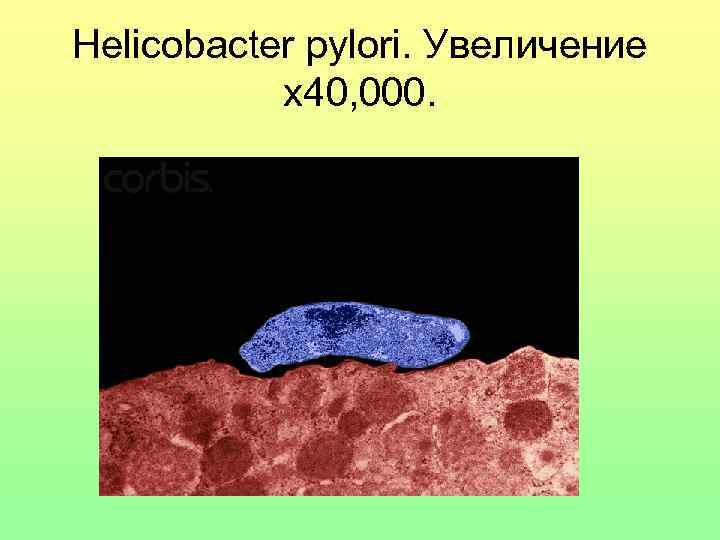 Helicobacter pylori. Увеличение x 40, 000. 