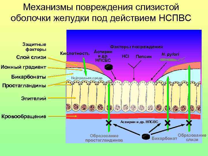 Механизмы повреждения слизистой оболочки желудки под действием НСПВС Защитные факторы Слой слизи Факторы повреждения