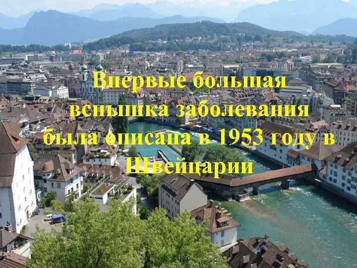 Впервые большая вспышка заболевания была описана в 1953 году в Швейцарии 