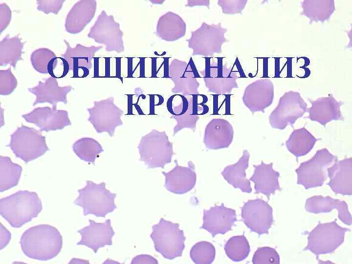 ОБЩИЙ АНАЛИЗ КРОВИ 