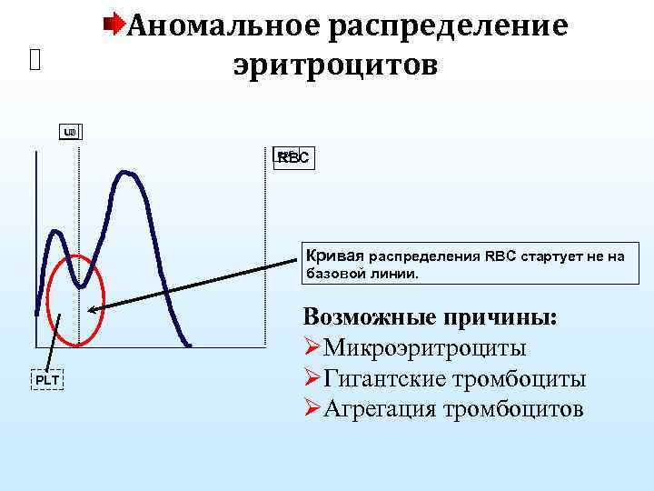 Аномальное распределение эритроцитов LD LD RBC Кривая распределения RBC стартует не на базовой линии.