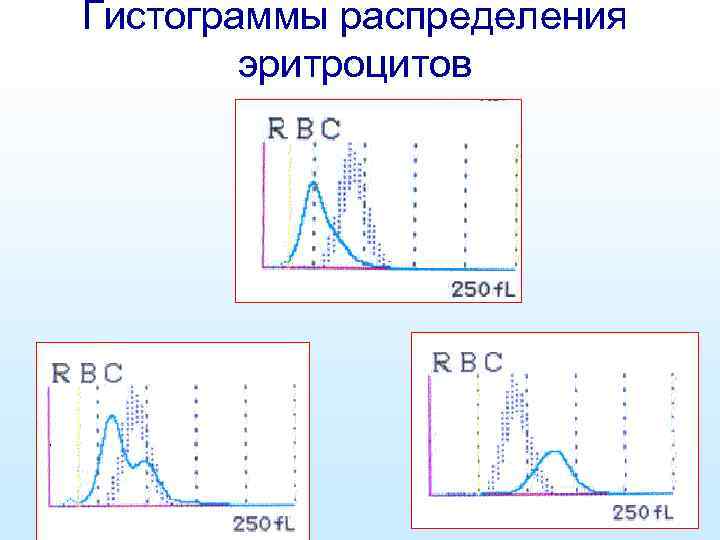 Гистограммы распределения эритроцитов 