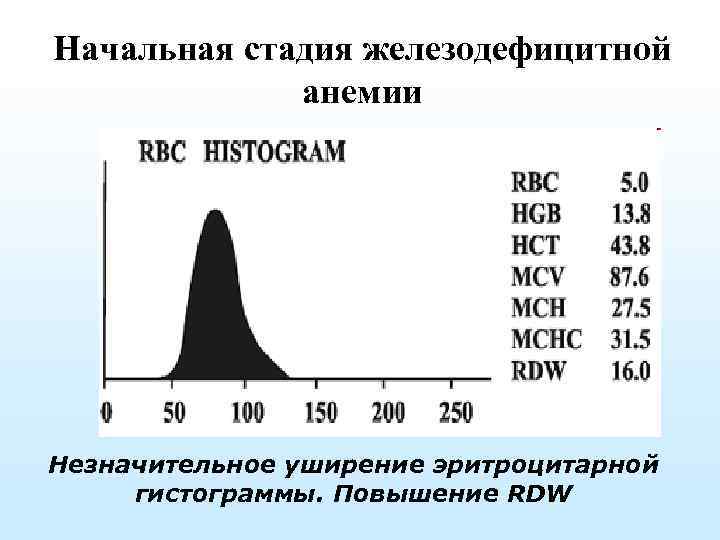 Начальная стадия железодефицитной анемии Незначительное уширение эритроцитарной гистограммы. Повышение RDW 