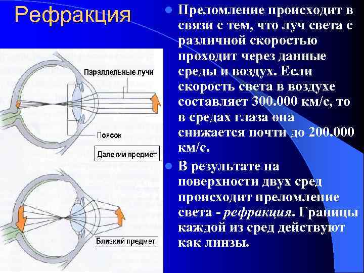 Рефракция Преломление происходит в связи с тем, что луч света с различной скоростью проходит
