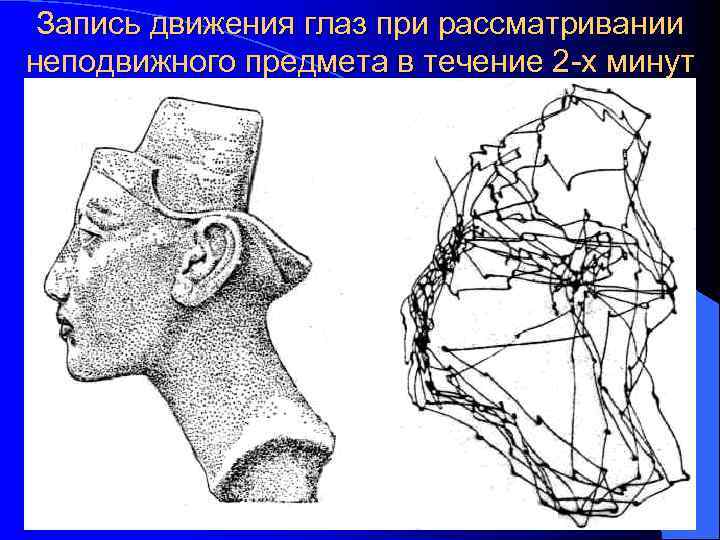 Запись движения глаз при рассматривании неподвижного предмета в течение 2 -х минут 