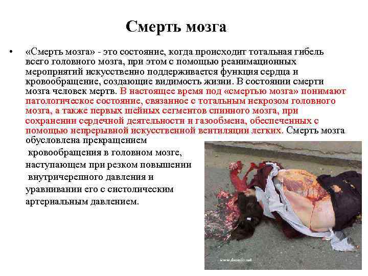  • Смерть мозга «Смерть мозга» это состояние, когда происходит тотальная гибель всего головного