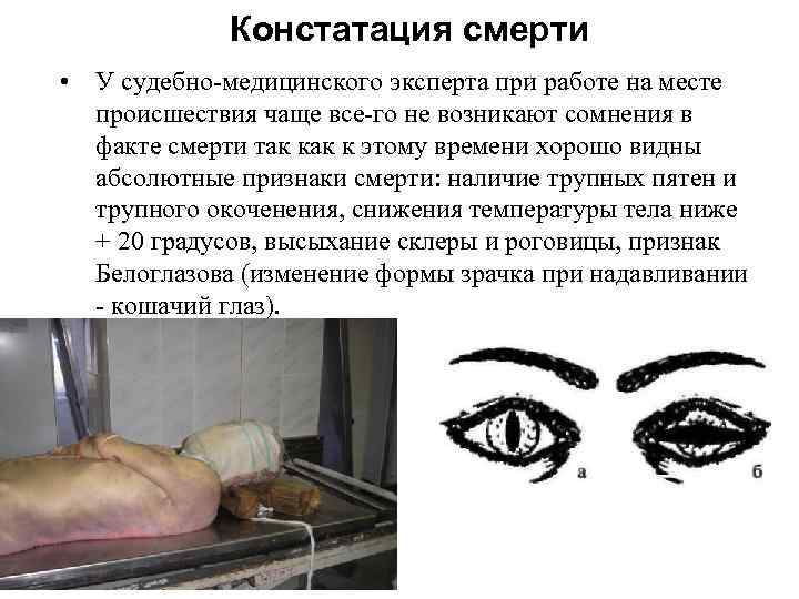 Констатация смерти • У судебно медицинского эксперта при работе на месте происшествия чаще все