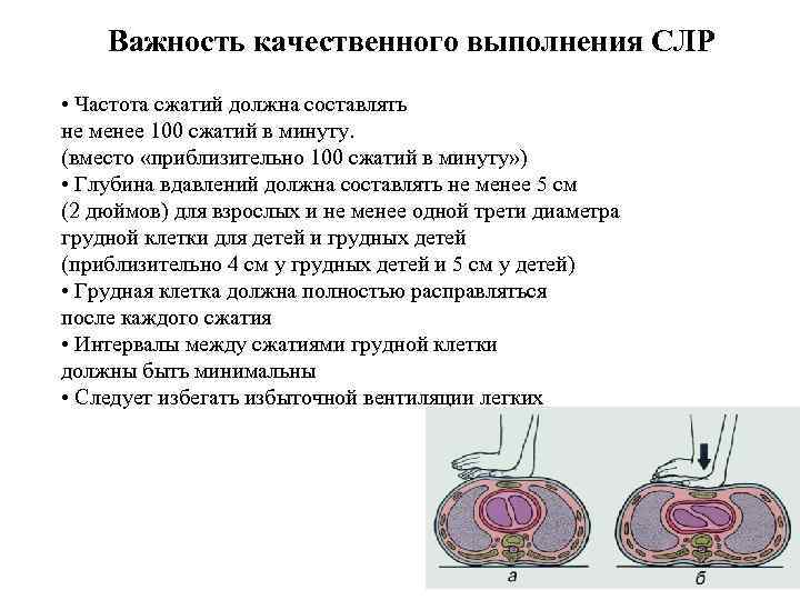 Важность качественного выполнения СЛР • Частота сжатий должна составлять не менее 100 сжатий в