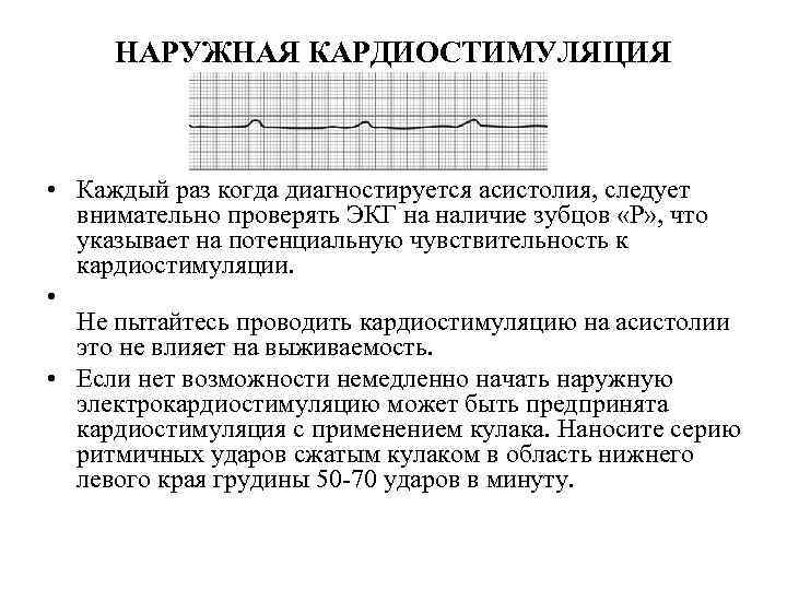 НАРУЖНАЯ КАРДИОСТИМУЛЯЦИЯ • Каждый раз когда диагностируется асистолия, следует внимательно проверять ЭКГ на наличие