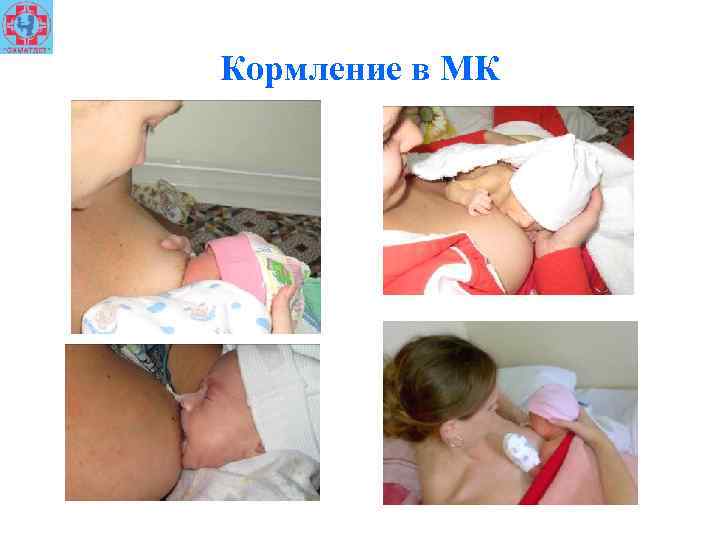 Кормление в МК 