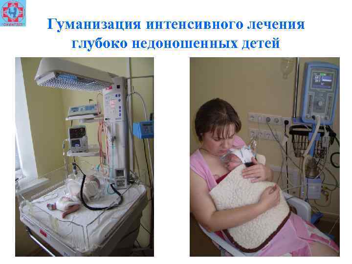 Гуманизация интенсивного лечения глубоко недоношенных детей 