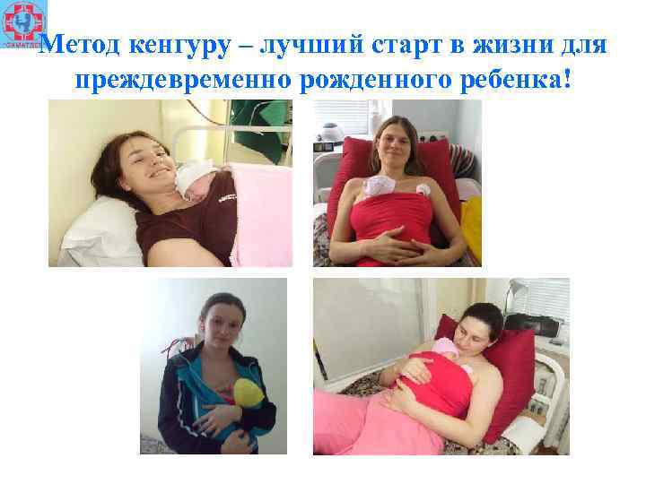 Метод кенгуру – лучший старт в жизни для преждевременно рожденного ребенка! 