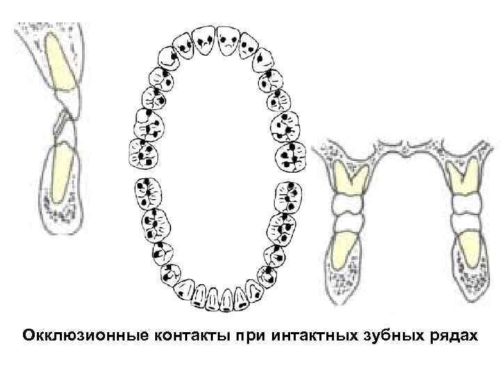 Окклюзионная схема кувата