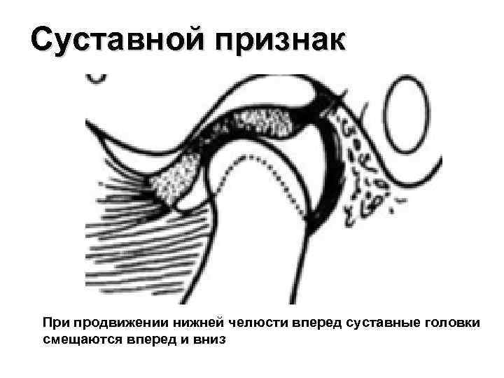 Признаки окклюзии