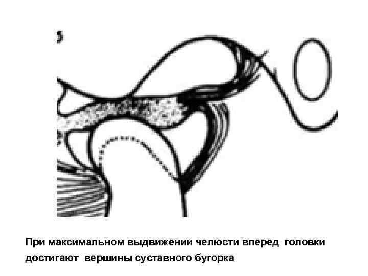 Артикуляция и окклюзия