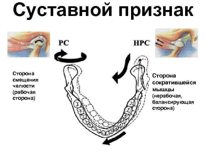 Признаки окклюзии