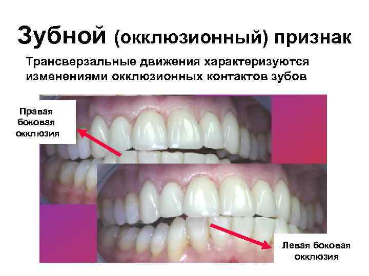 Центральной окклюзии зубной