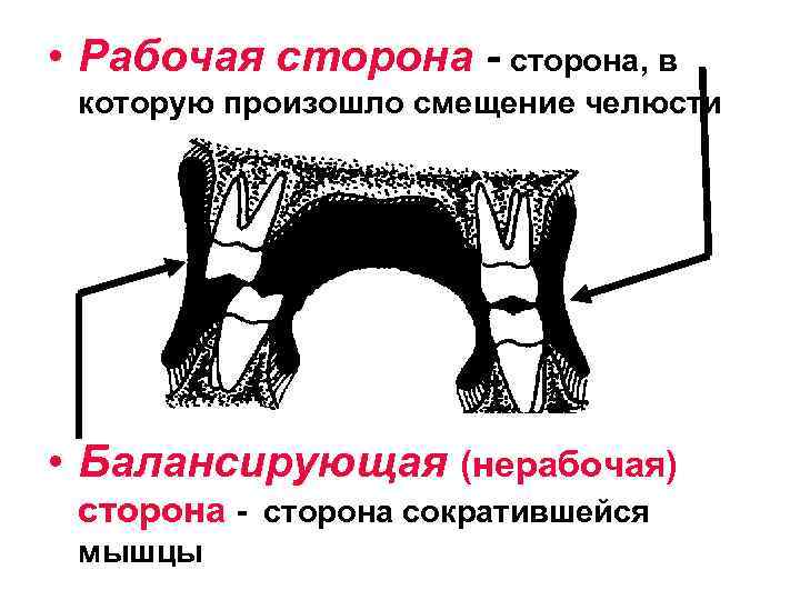 Нерабочая сторона. Рабочая и балансирующая сторона. Рабочая и балансирующая сторона нижней челюсти. Рабочая и балансирующая сторона в стоматологии. Понятие о рабочей и балансирующей сторонах.