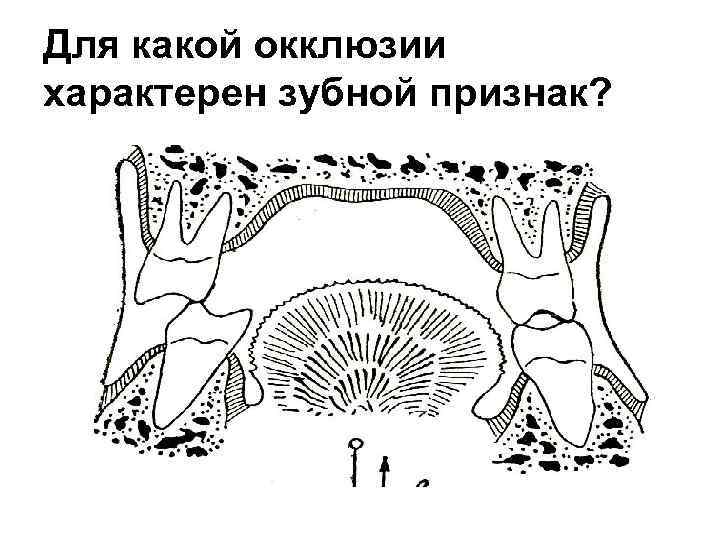 Артикуляция и окклюзия. Симптом склеивания зубов характерен для. Наклейки для окклюзии. Карта окклюзии. Фронт окклюзии.