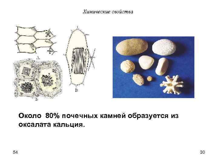 Химические свойства Около 80% почечных камней образуется из оксалата кальция. 54 30 