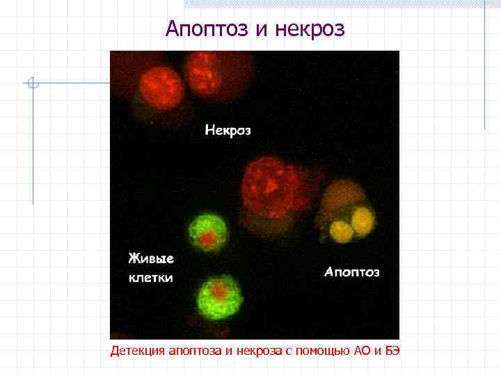 Апоптоз и некроз Детекция апоптоза и некроза с помощью АО и БЭ 