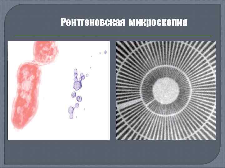 Рентгеновская микроскопия 