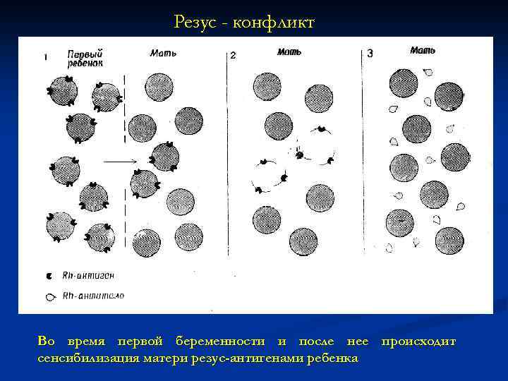 Резус - конфликт Во время первой беременности и после нее происходит сенсибилизация матери резус-антигенами