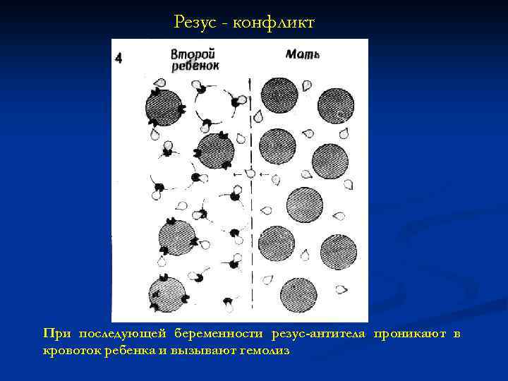 Резус - конфликт При последующей беременности резус-антитела проникают в кровоток ребенка и вызывают гемолиз
