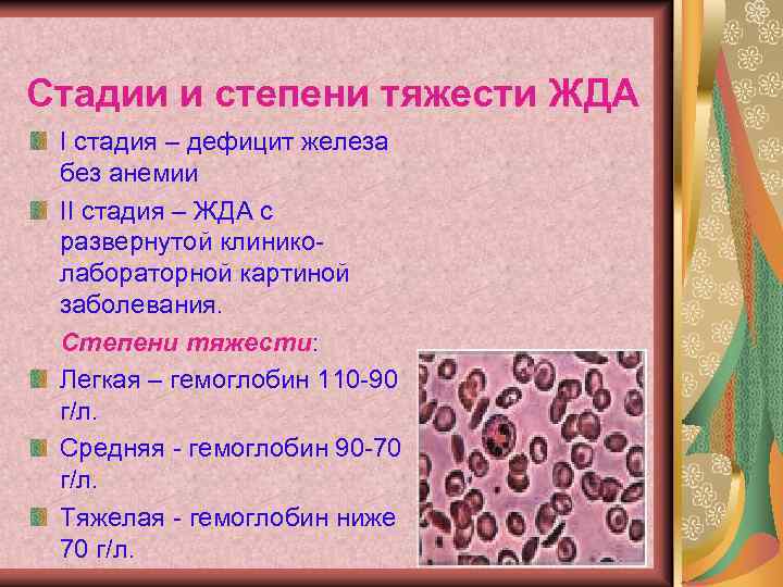 Стадии и степени тяжести ЖДА I стадия – дефицит железа без анемии II стадия