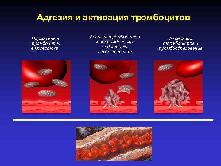 Адгезия в медицине. Адгезия и активация тромбоцитов. Адгезия и агрегация тромбоцитов. Адгезия тромбоцитов. Адгезия это в патологии.