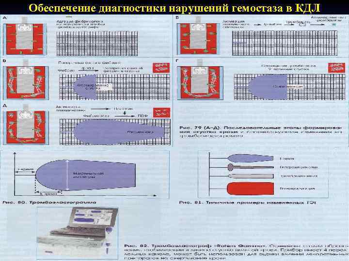 Обеспечение диагностики нарушений гемостаза в КДЛ 