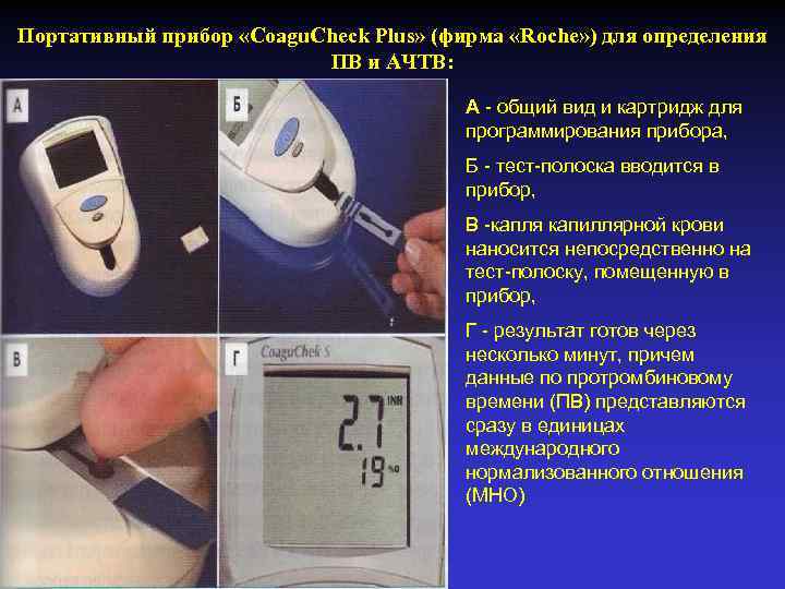 Портативный прибор «Coagu. Check Plus» (фирма «Roche» ) для определения ПВ и АЧТВ: А