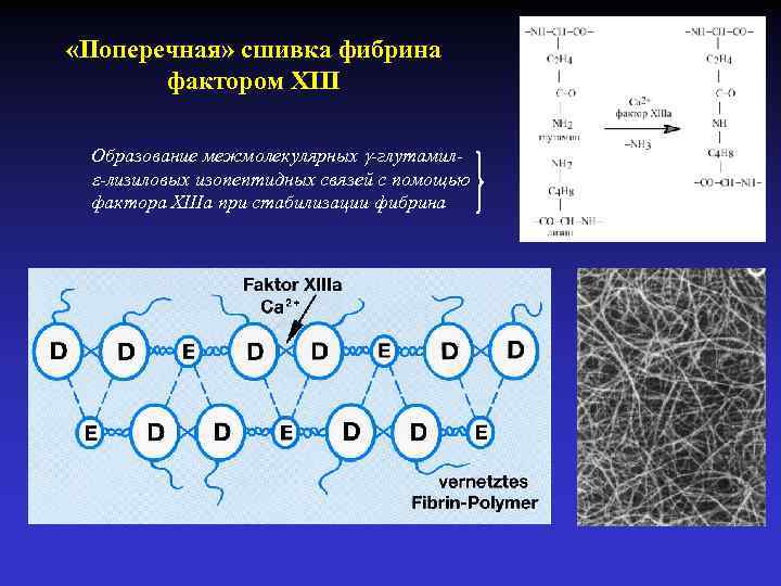  «Поперечная» сшивка фибрина фактором XIII Образование межмолекулярных -глутамил -лизиловых изопептидных связей с помощью