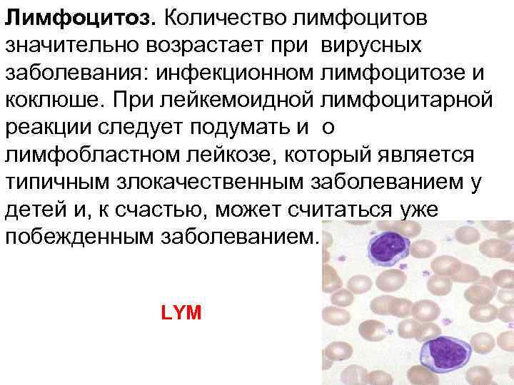 Лимфоцитоз. Количество лимфоцитов значительно возрастает при вирусных заболевания: инфекционном лимфоцитозе и коклюше. При лейкемоидной