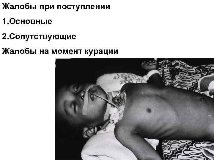 Жалобы при поступлении 1. Основные 2. Сопутствующие Жалобы на момент курации 