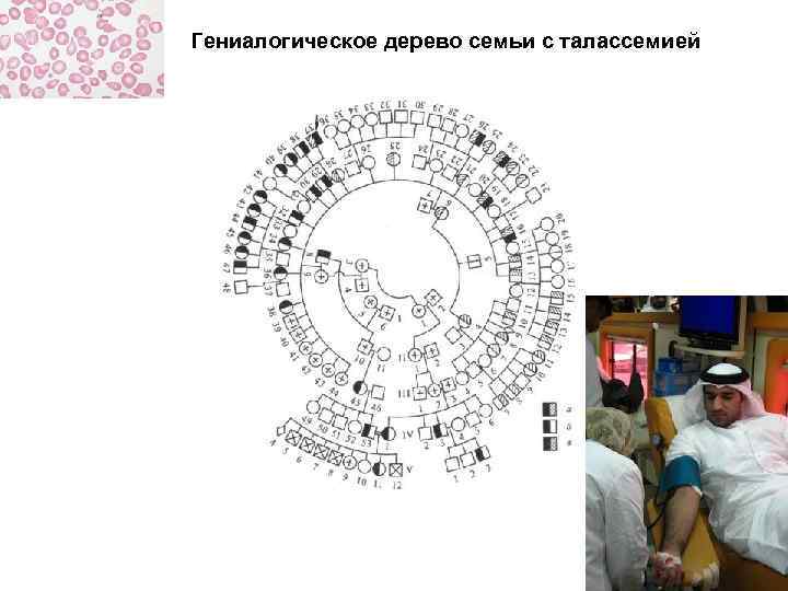 Гениалогическое дерево семьи с талассемией 