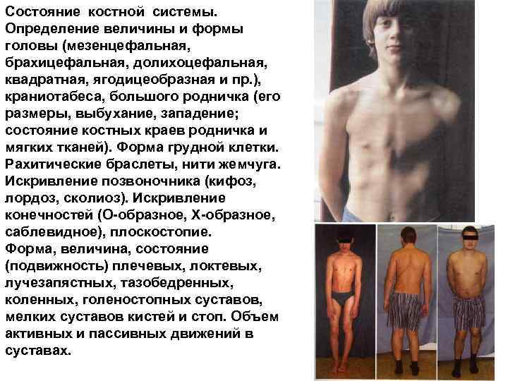 Состояние костной системы. Определение величины и формы головы (мезенцефальная, брахицефальная, долихоцефальная, квадратная, ягодицеобразная и