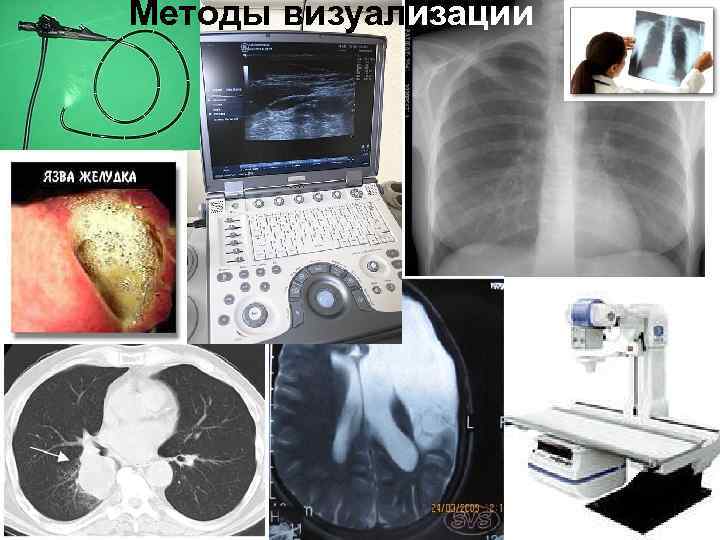 Методы визуализации 