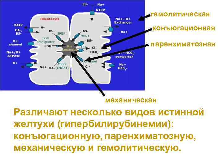 гемолитическая конъюгационная паренхиматозная механическая Различают несколько видов истинной желтухи (гипербилирубинемии): конъюгационную, паренхиматозную, механическую и