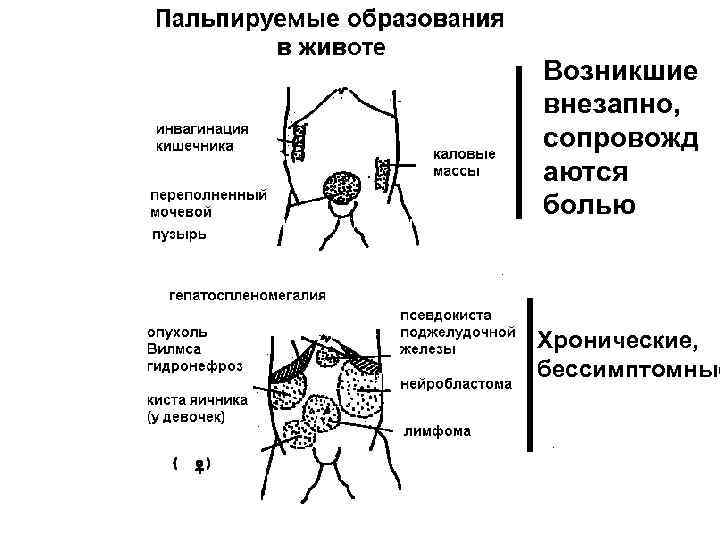 Возникшие внезапно, сопровожд аются болью Хронические, бессимптомные 