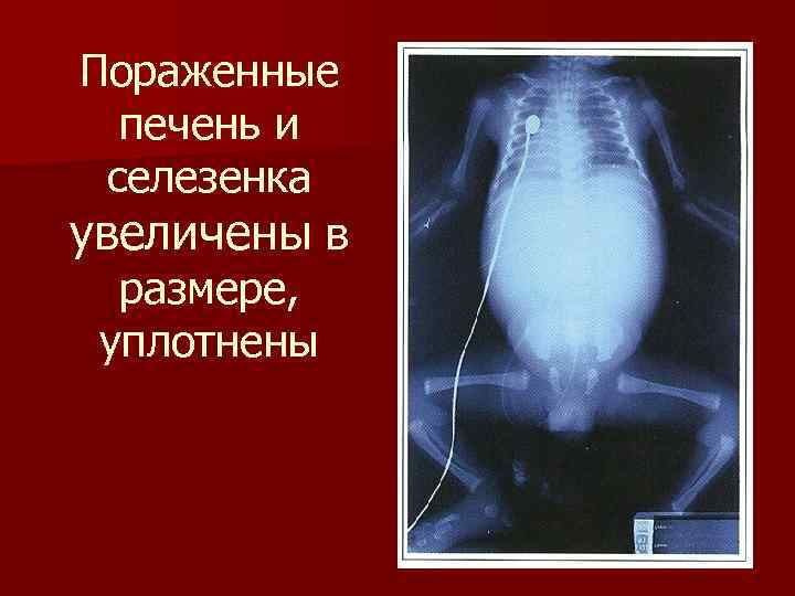 Пораженные печень и селезенка увеличены в размере, уплотнены 