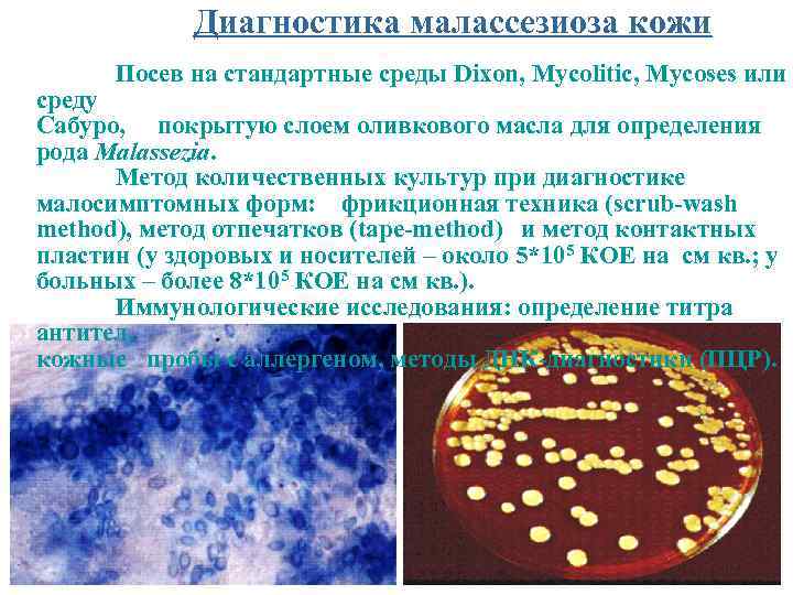 Диагностика малассезиоза кожи Посев на стандартные среды Dixon, Mycolitic, Mycoses или среду Сабуро, покрытую