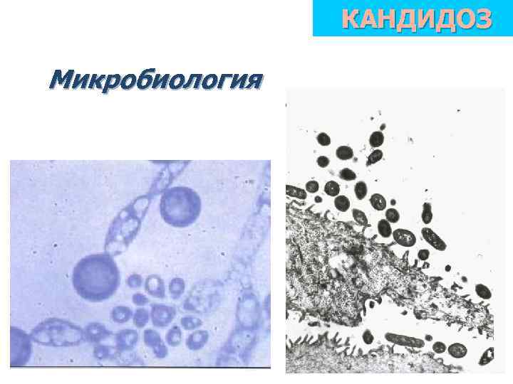 КАНДИДОЗ Микробиология 