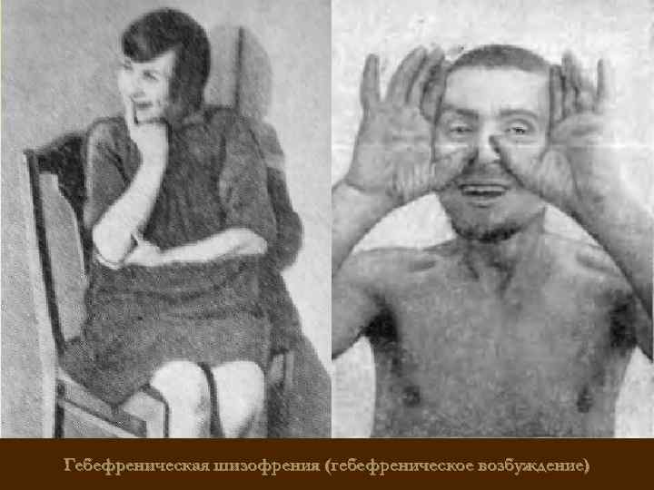 Гебефреническая шизофрения (гебефреническое возбуждение) 