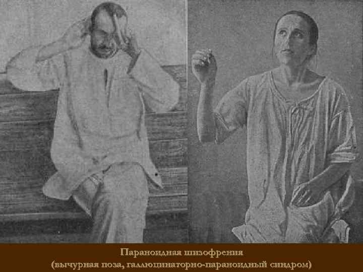 Параноидная шизофрения (вычурная поза, галлюцинаторно-параноидный синдром) 