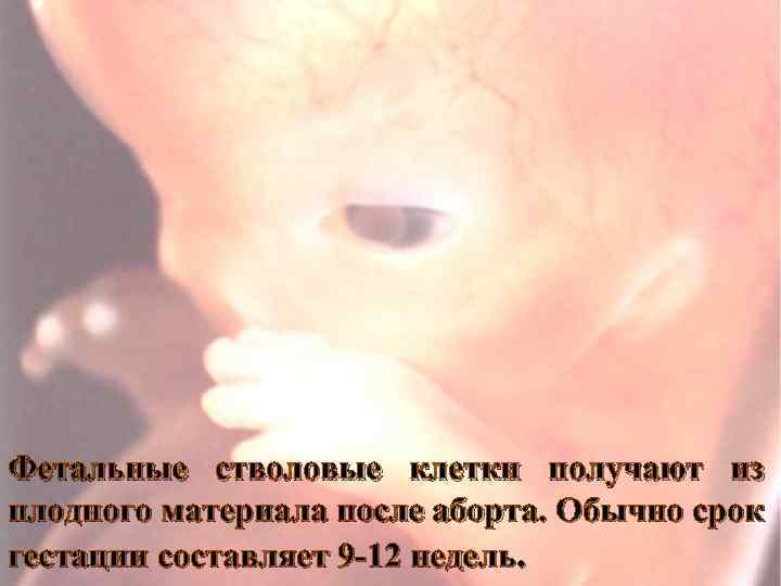 Фетальные стволовые клетки получают из плодного материала после аборта. Обычно срок гестации составляет 9